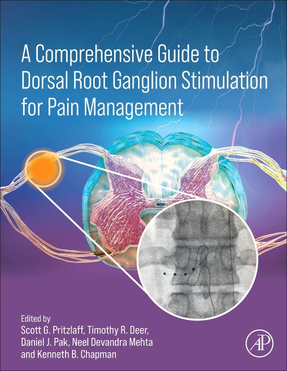 A Comprehensive Guide to Dorsal Root Ganglion Stimulation for Pain Management by Scott G. Pritzlaff, Hardcover | Indigo Chapters