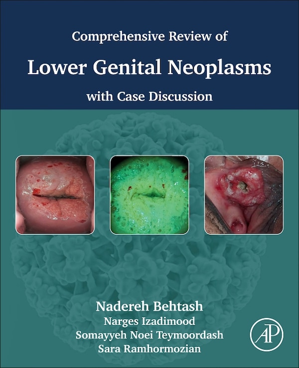 Comprehensive review of lower genital neoplasms by Nadereh Behtash, Paperback | Indigo Chapters
