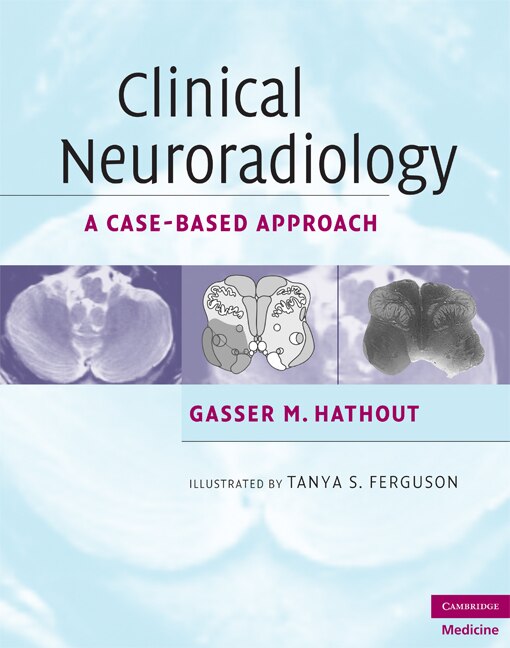 Clinical Neuroradiology by Gasser M. Hathout, Hardcover | Indigo Chapters