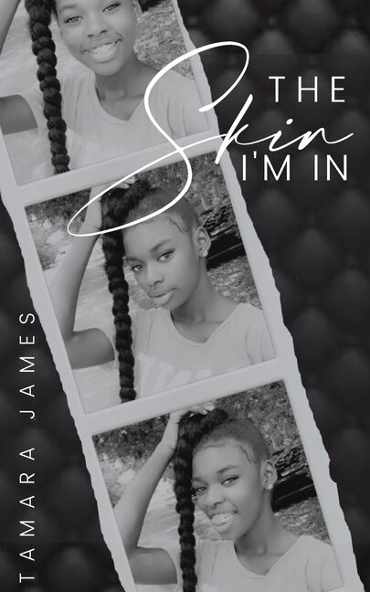 The Skin I'm In by Tamara James, Paperback | Indigo Chapters