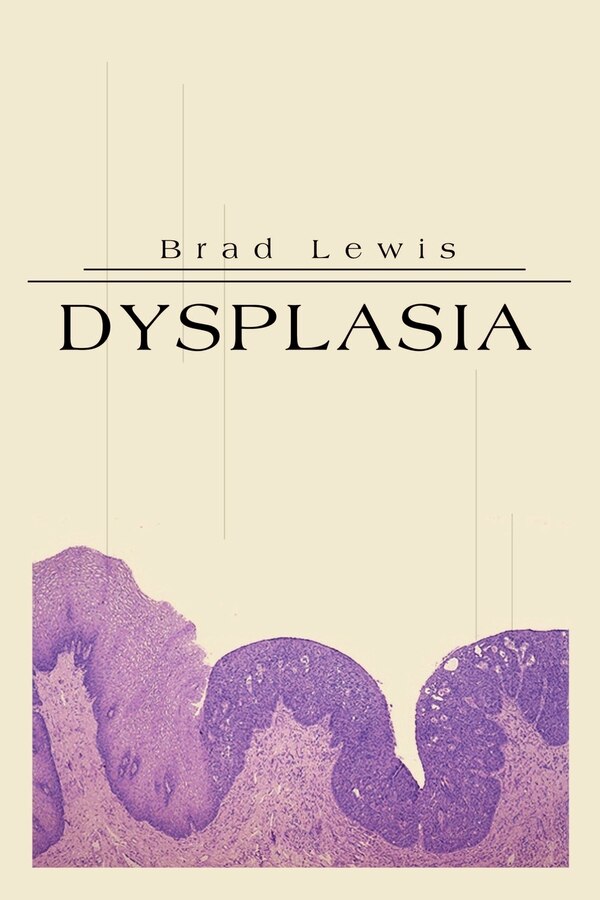 Dysplasia by Brad B Lewis, Paperback | Indigo Chapters