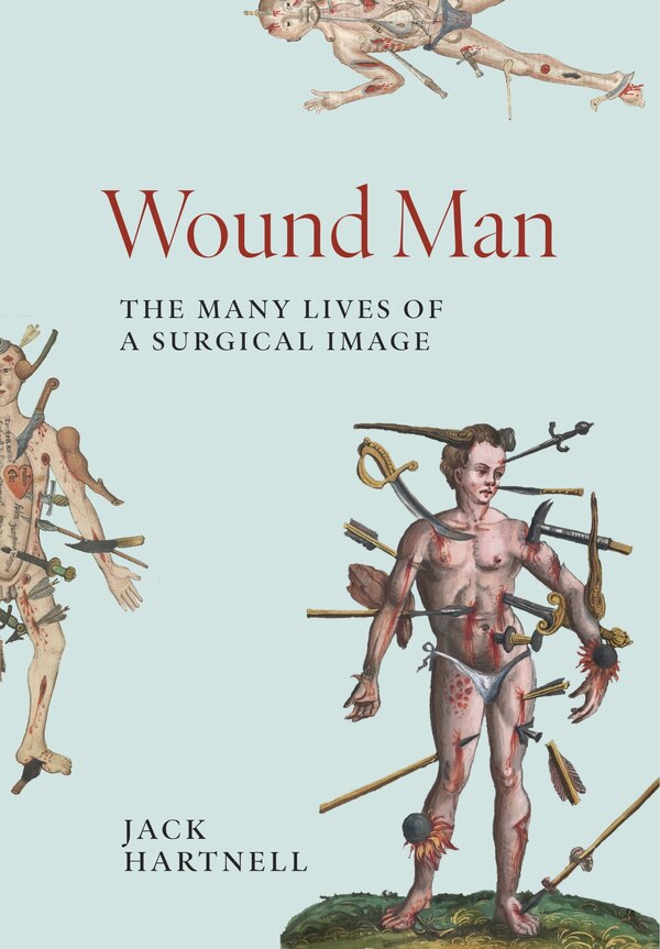 Wound Man by Jack Hartnell, Hardcover | Indigo Chapters