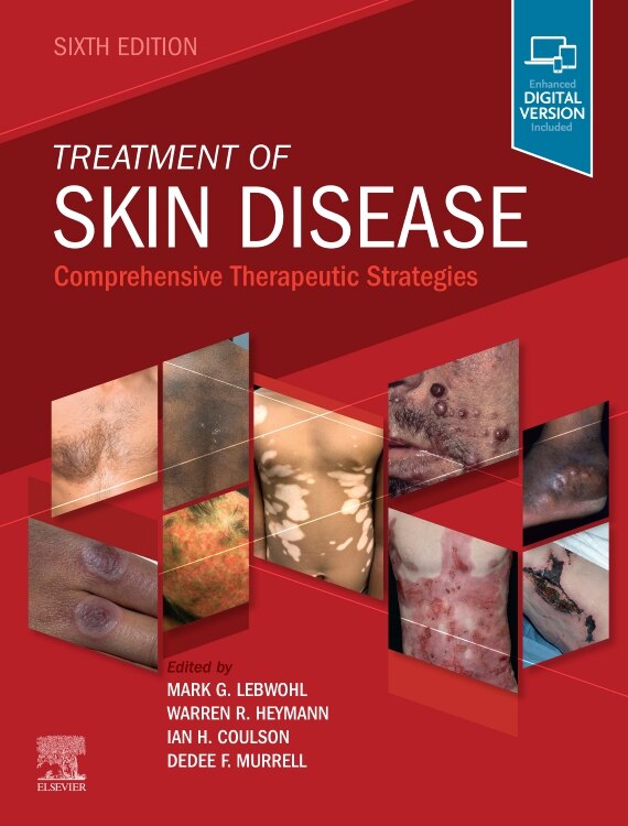 Treatment Of Skin Disease by Mark Lebwohl, Hardcover | Indigo Chapters