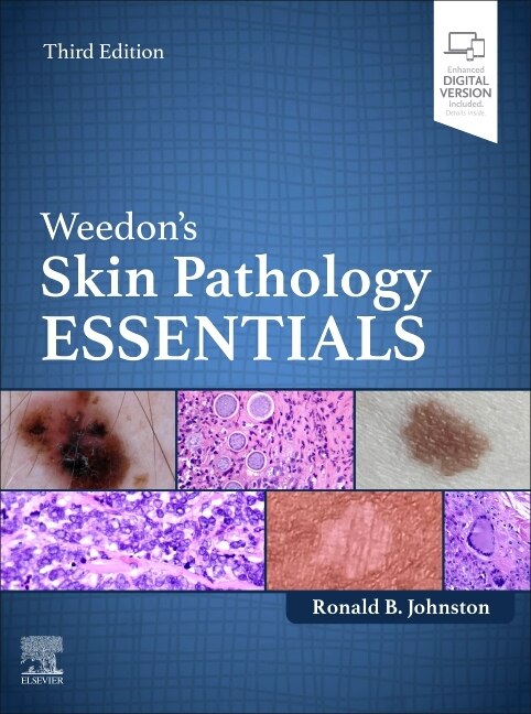 Weedon's Skin Pathology Essentials by Ronald Johnston, Hardcover | Indigo Chapters