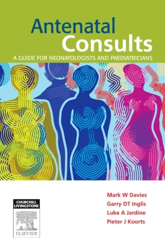 Antenatal Consults by Mark Davies, Paperback | Indigo Chapters