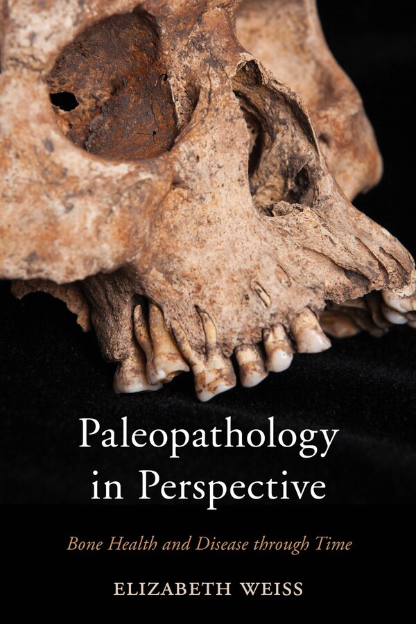 Paleopathology In Perspective by Elizabeth Weiss, Hardcover | Indigo Chapters