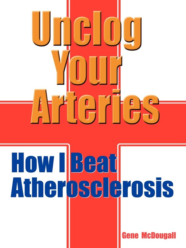 Unclog Your Arteries by Gene McDougall, Paperback | Indigo Chapters