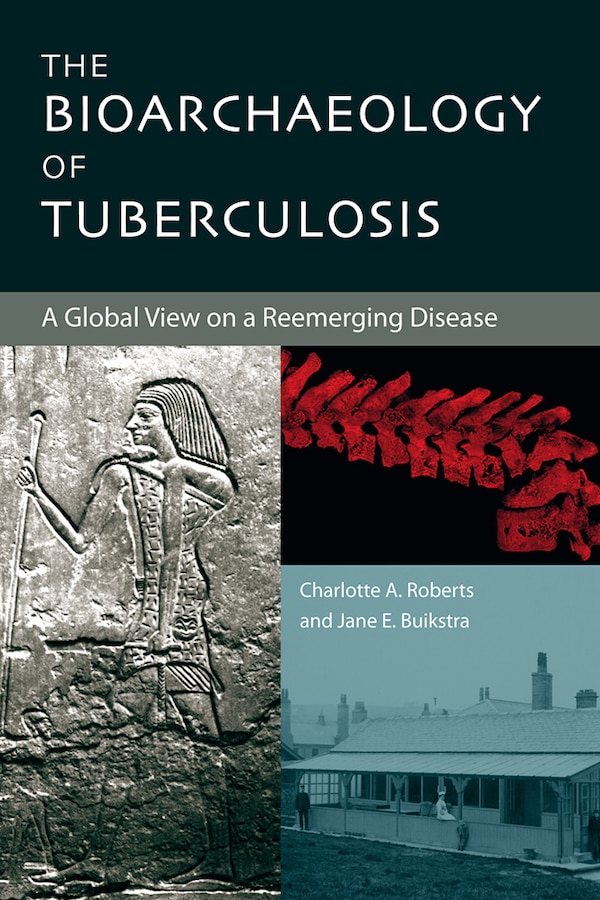 The Bioarchaeology of Tuberculosis by Charlotte Roberts, Paperback | Indigo Chapters