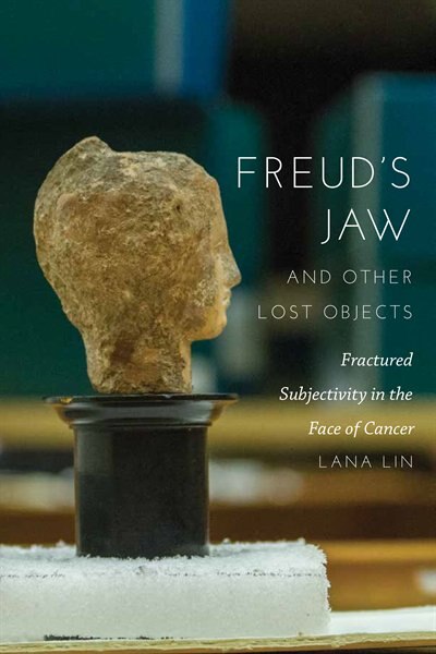 Freud's Jaw And Other Lost Objects by Lana Lin, Paperback | Indigo Chapters