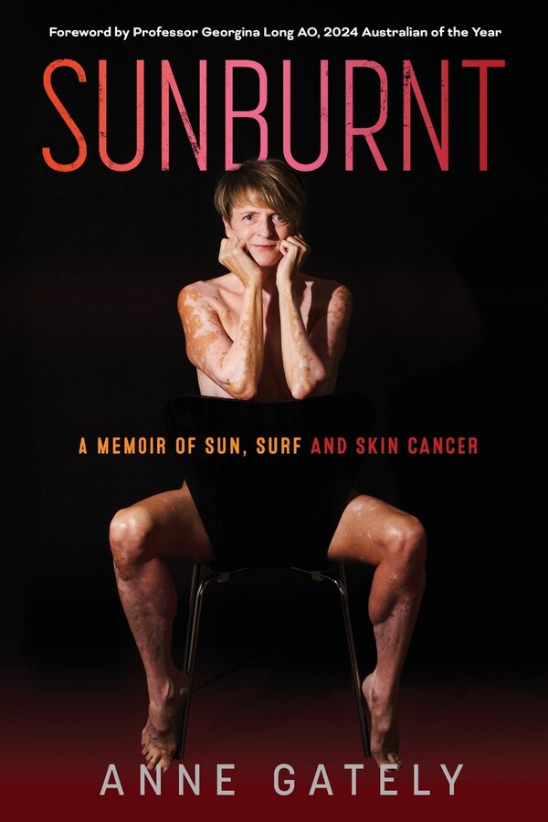 Sunburnt by Anne C Gately, Paperback | Indigo Chapters