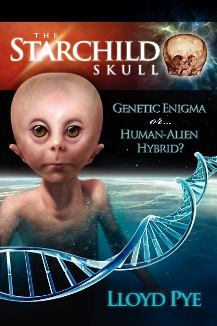 The Starchild Skull - Genetic Enigma or Human-Alien Hybrid? by Lloyd Pye, Paperback | Indigo Chapters
