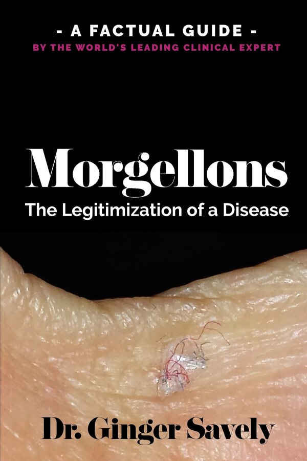 Morgellons by Ginger Savely, Paperback | Indigo Chapters
