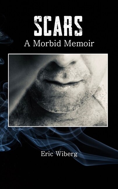 Scars by Eric Wiberg, Paperback | Indigo Chapters