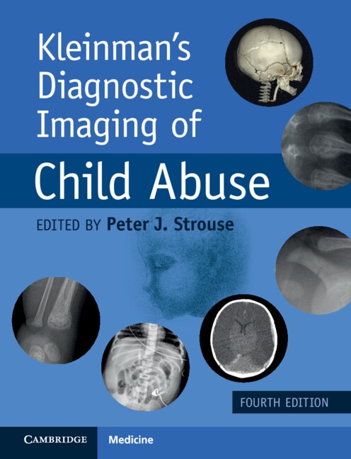 Kleinman's Diagnostic Imaging of Child Abuse by Peter J. Strouse, Hardcover | Indigo Chapters