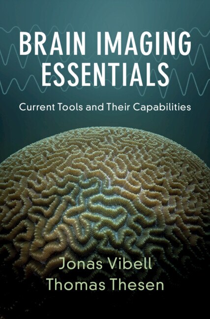 Brain Imaging Essentials by Jonas Vibell, Hardcover | Indigo Chapters
