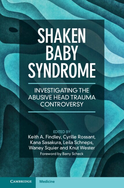 Shaken Baby Syndrome by Keith A. Findley, Hardcover | Indigo Chapters