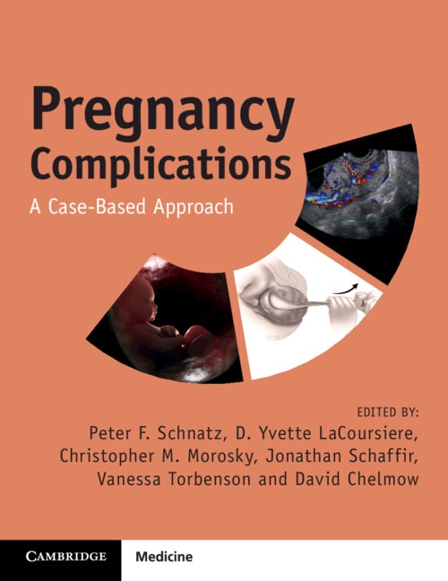 Pregnancy Complications by Peter F. Schnatz, Paperback | Indigo Chapters