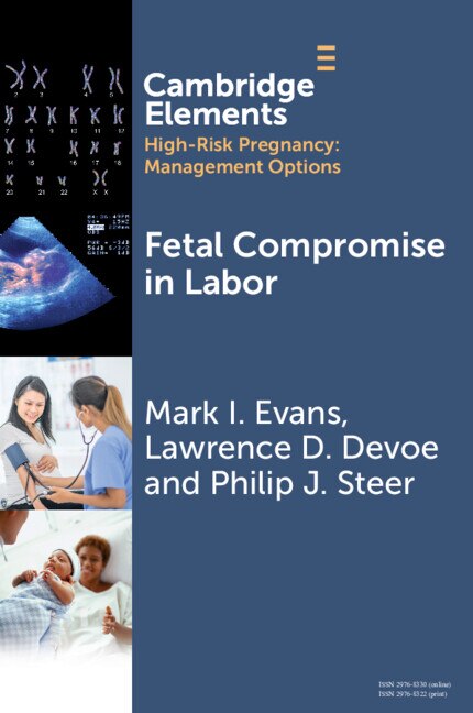 Fetal Compromise in Labor by Mark I. Evans, Paperback | Indigo Chapters
