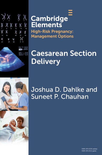 Caesarean Section Delivery by Joshua D. Dahlke, Paperback | Indigo Chapters
