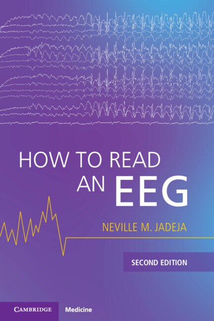 How to Read an EEG by Neville M. Jadeja, Paperback | Indigo Chapters