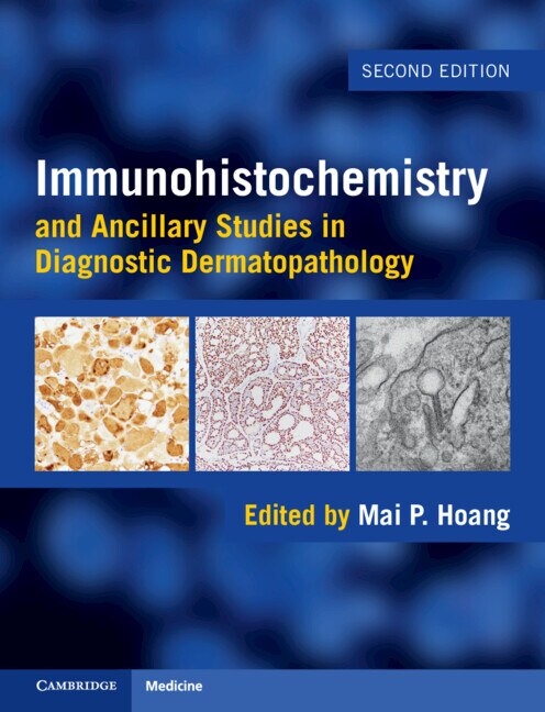 Immunohistochemistry and Ancillary Studies in Diagnostic Dermatopathology by Mai P. Hoang, Hardcover | Indigo Chapters