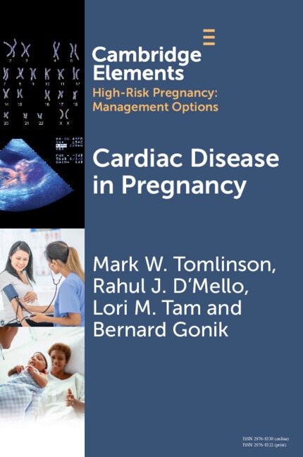 Cardiac Disease in Pregnancy by Mark W. Tomlinson, Paperback | Indigo Chapters