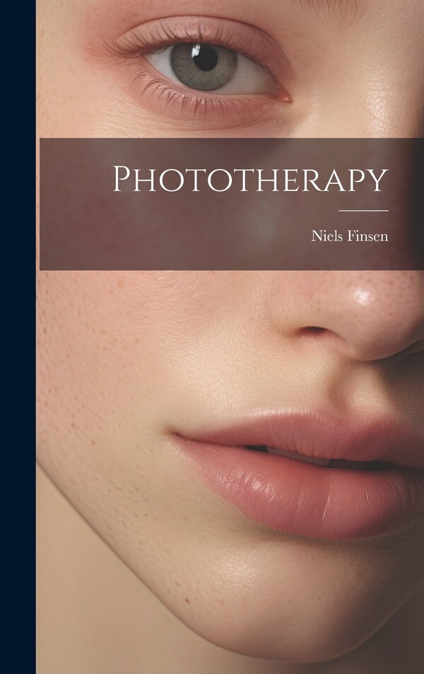 Phototherapy by Niels Finsen, Hardcover | Indigo Chapters