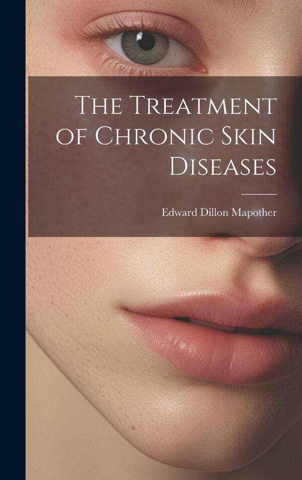 The Treatment of Chronic Skin Diseases by Edward Dillon Mapother, Hardcover | Indigo Chapters