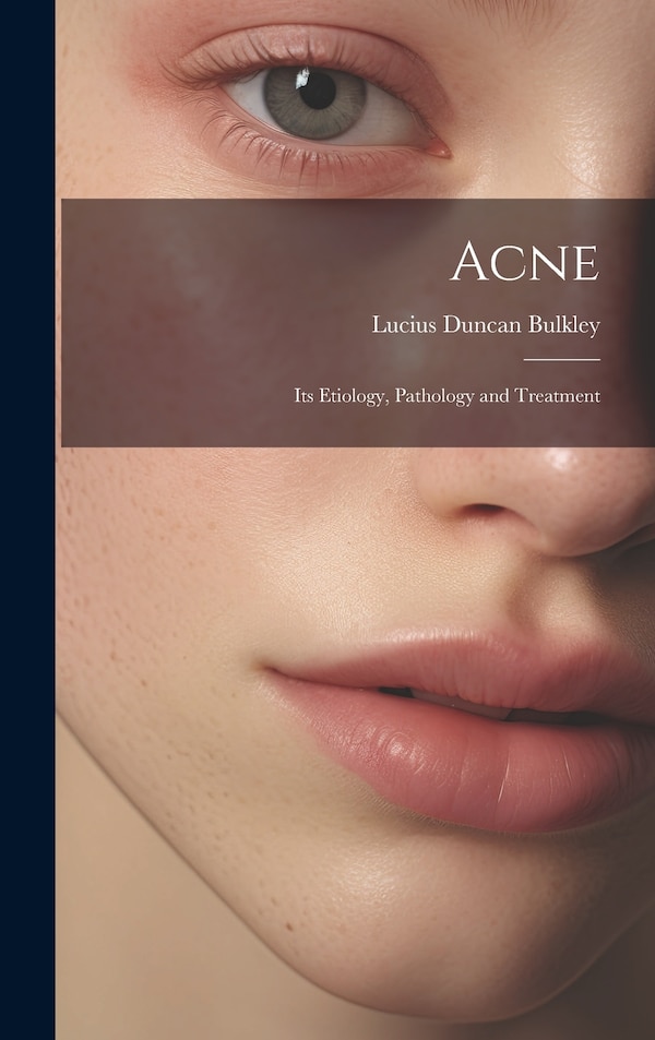 Acne by Lucius Duncan Bulkley, Hardcover | Indigo Chapters