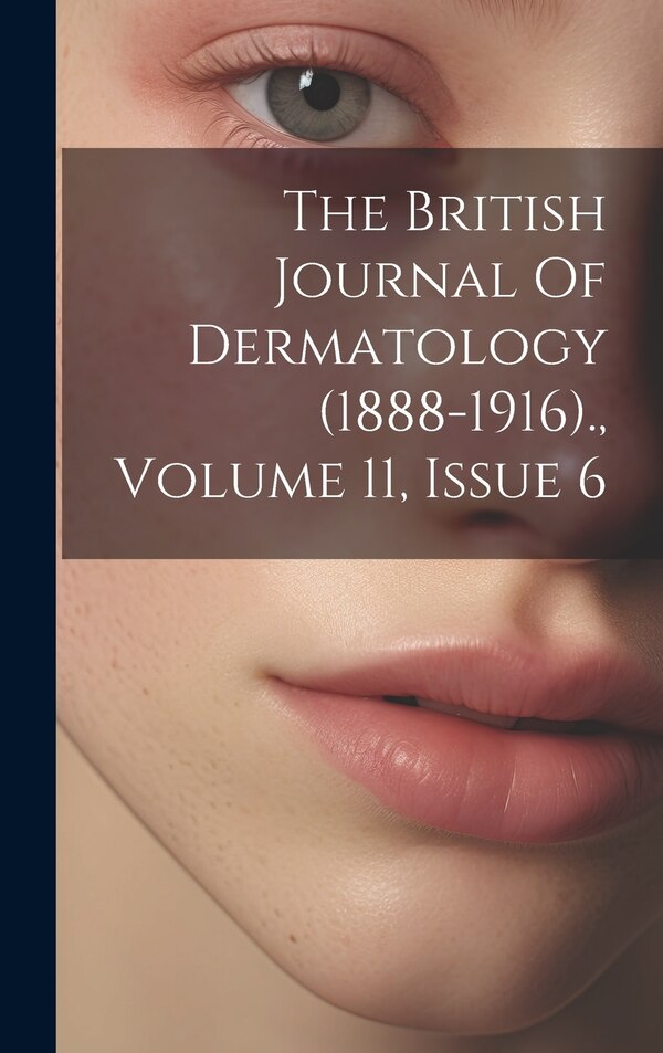 The British Journal Of Dermatology (1888-1916). Volume 11 Issue 6 by Anonymous, Hardcover | Indigo Chapters
