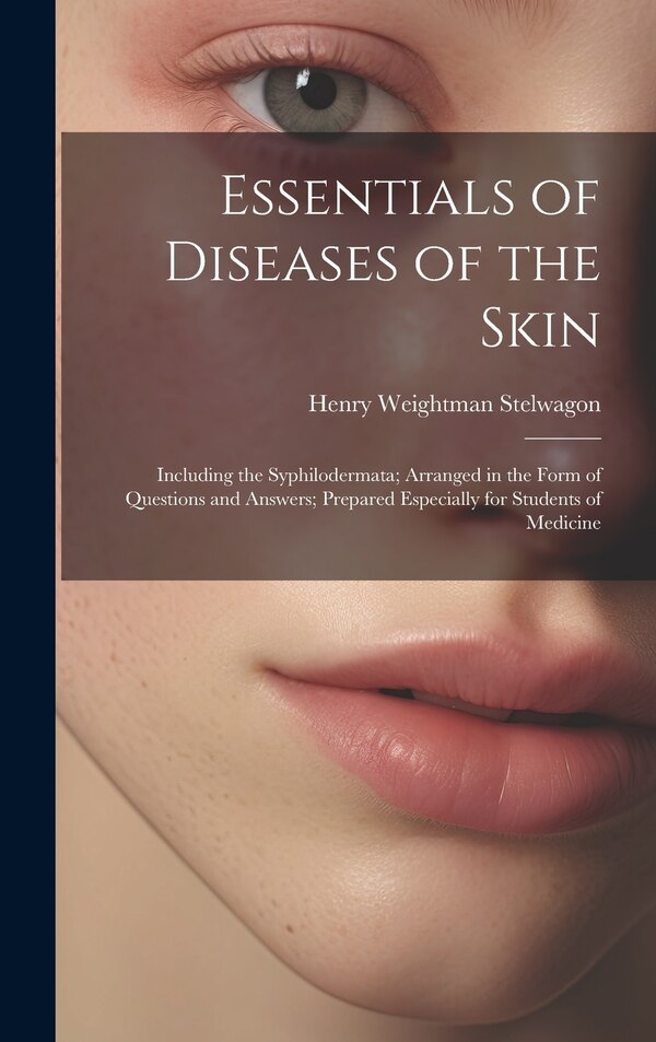 Essentials of Diseases of the Skin by Henry Weightman Stelwagon, Hardcover | Indigo Chapters
