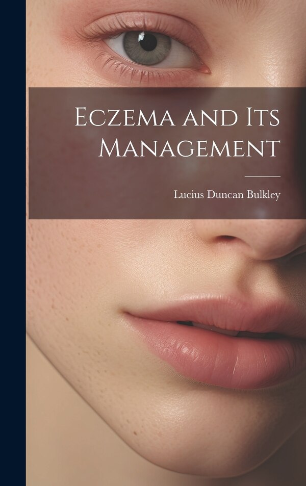 Eczema and Its Management by Lucius Duncan Bulkley, Hardcover | Indigo Chapters