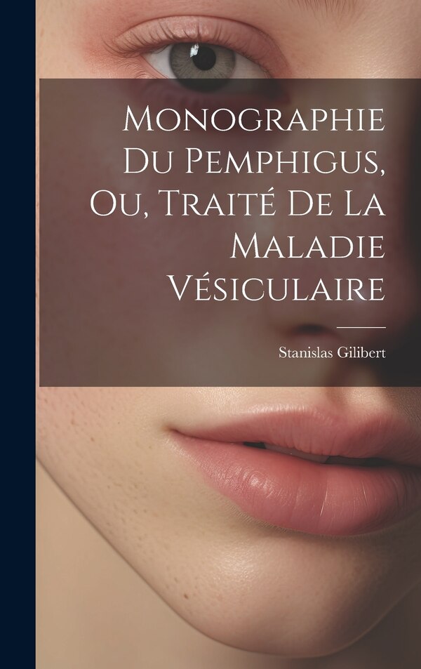 Monographie Du Pemphigus Ou Traité De La Maladie Vésiculaire by Stanislas Gilibert, Hardcover | Indigo Chapters