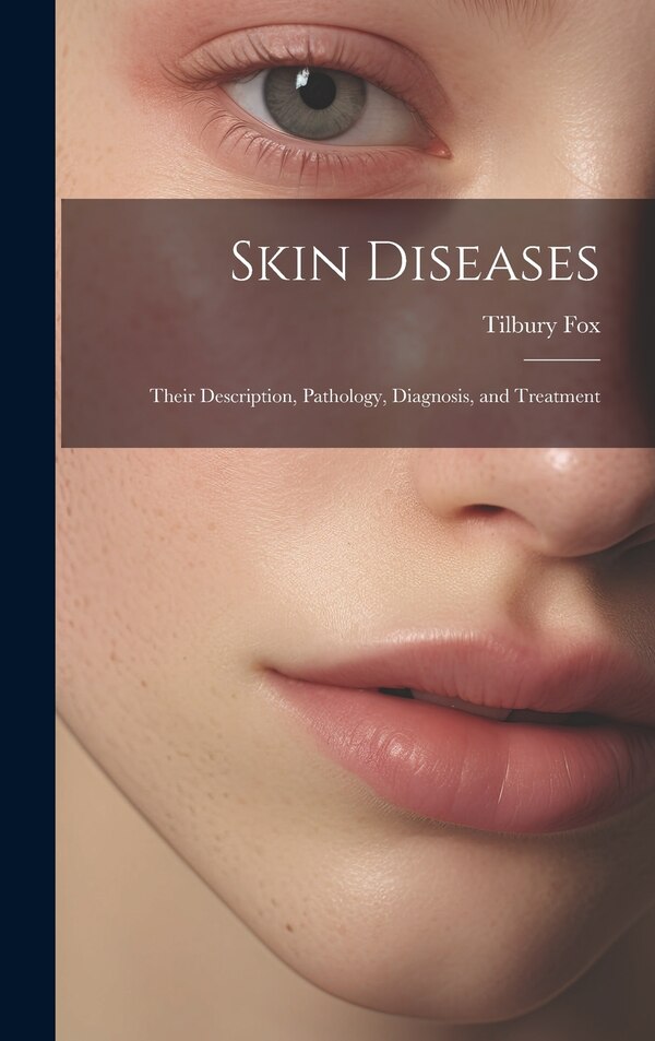 Skin Diseases by Tilbury Fox, Hardcover | Indigo Chapters