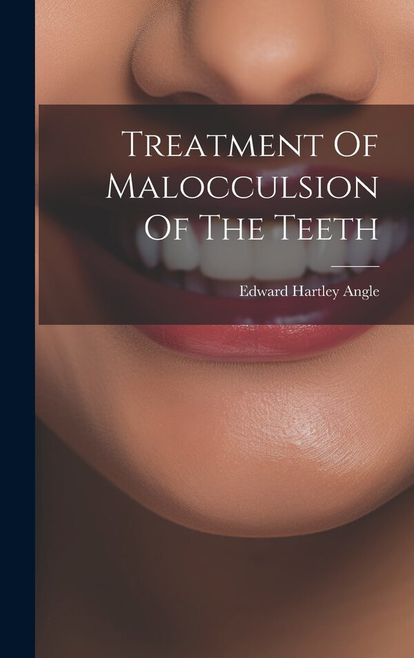 Treatment Of Malocculsion Of The Teeth by Edward Hartley Angle, Hardcover | Indigo Chapters