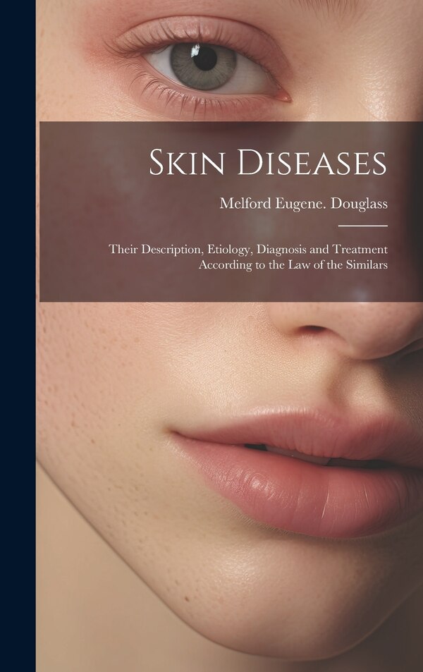 Skin Diseases by Melford Eugene Douglass, Hardcover | Indigo Chapters