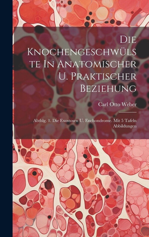 Die Knochengeschwülste In Anatomischer U. Praktischer Beziehung by Carl Otto Weber, Hardcover | Indigo Chapters