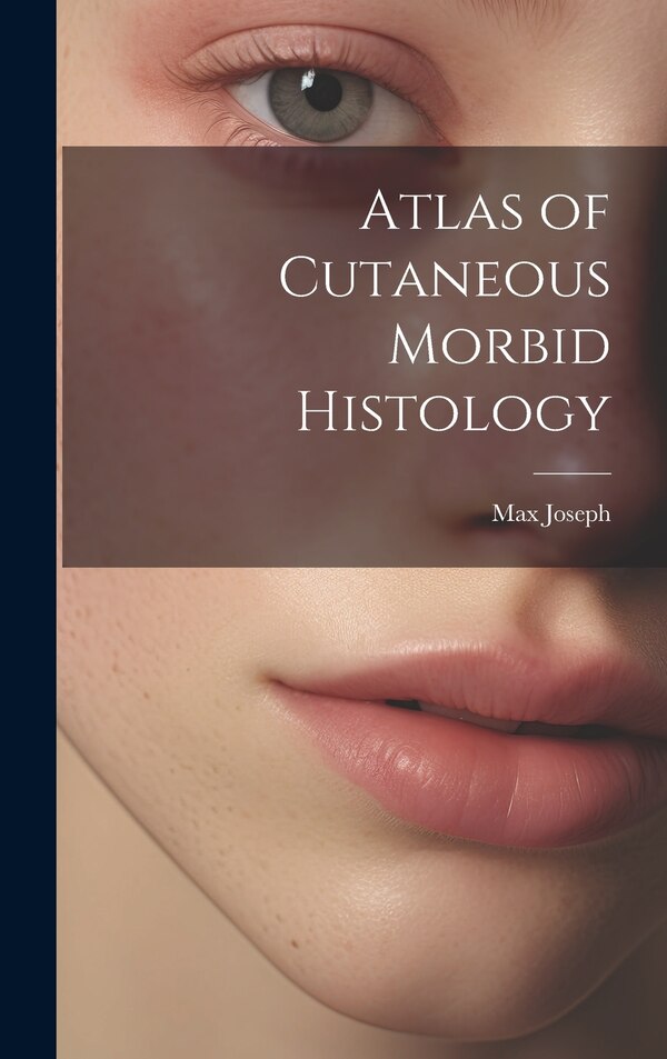 Atlas of Cutaneous Morbid Histology by Max Joseph, Hardcover | Indigo Chapters