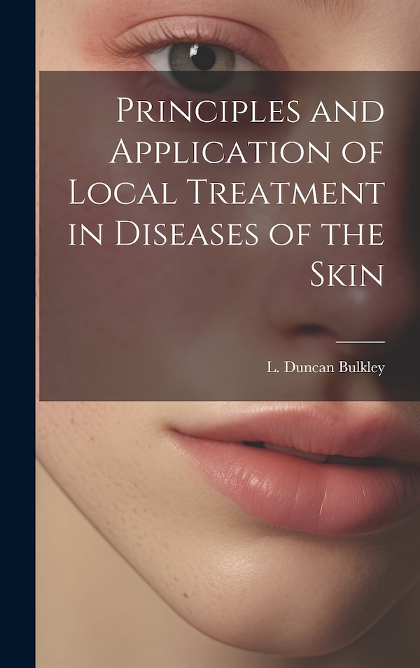 Principles and Application of Local Treatment in Diseases of the Skin by L Duncan Bulkley, Hardcover | Indigo Chapters
