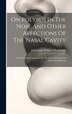 On Polypus In The Nose And Other Affections Of The Nasal Cavity by John Louis William Thudichum, Hardcover | Indigo Chapters