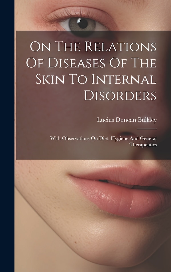 On The Relations Of Diseases Of The Skin To Internal Disorders by Lucius Duncan Bulkley, Hardcover | Indigo Chapters