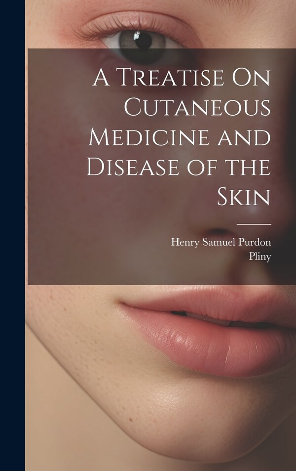 A Treatise On Cutaneous Medicine and Disease of the Skin by Pliny, Hardcover | Indigo Chapters