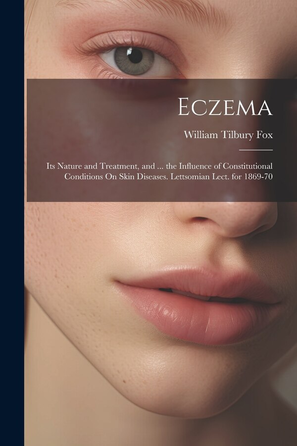 Eczema by William Tilbury Fox, Paperback | Indigo Chapters