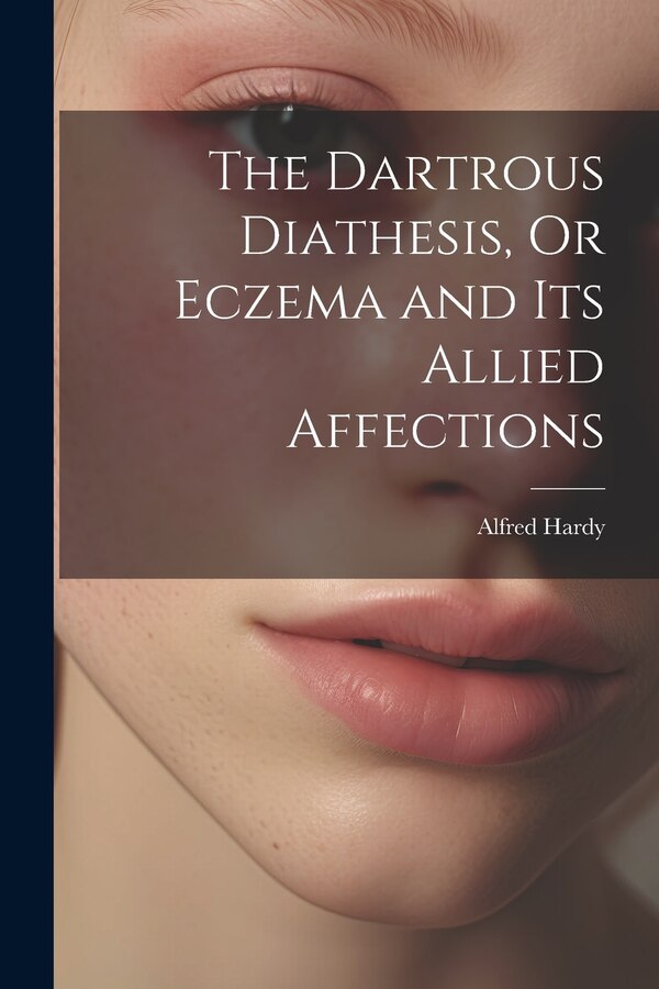 The Dartrous Diathesis Or Eczema and Its Allied Affections by Alfred Hardy, Paperback | Indigo Chapters