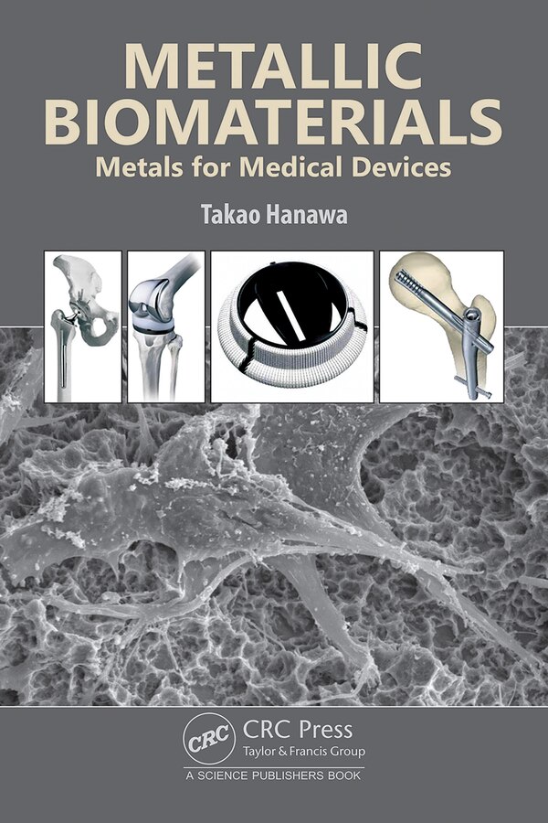 Metallic Biomaterials by Takao Hanawa, Hardcover | Indigo Chapters