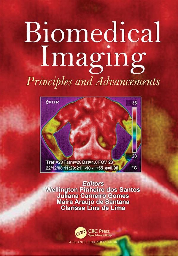 Biomedical Imaging by Wellington Pinheiro dos Santos, Hardcover | Indigo Chapters