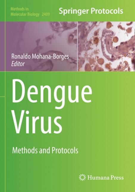 Dengue Virus by Ronaldo Mohana-borges, Paperback | Indigo Chapters