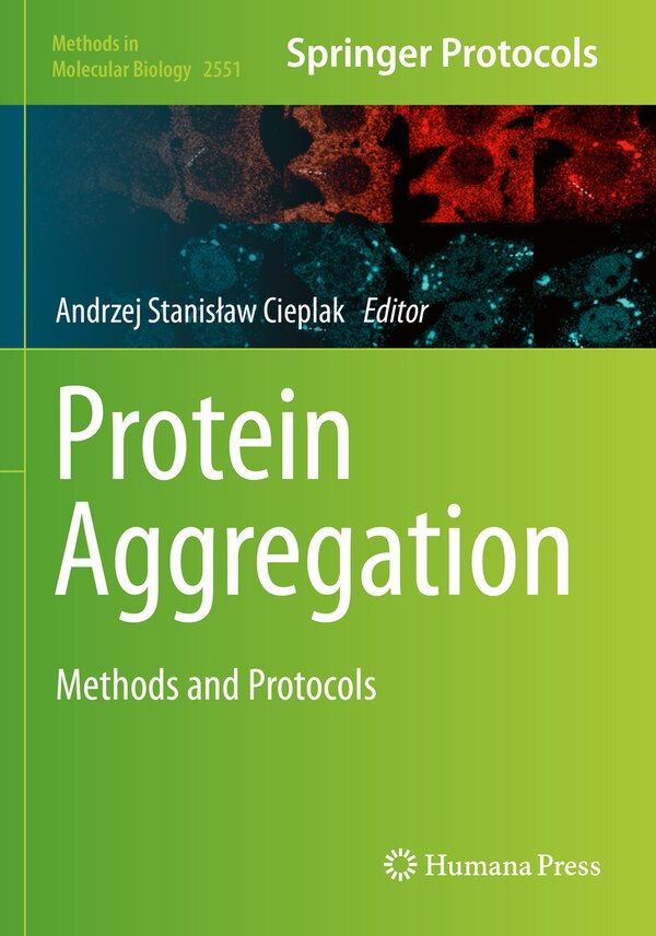 Protein Aggregation by Andrzej Stanis Cieplak, Paperback | Indigo Chapters
