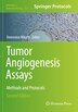 Tumor Angiogenesis Assays by Domenico Ribatti, Paperback | Indigo Chapters