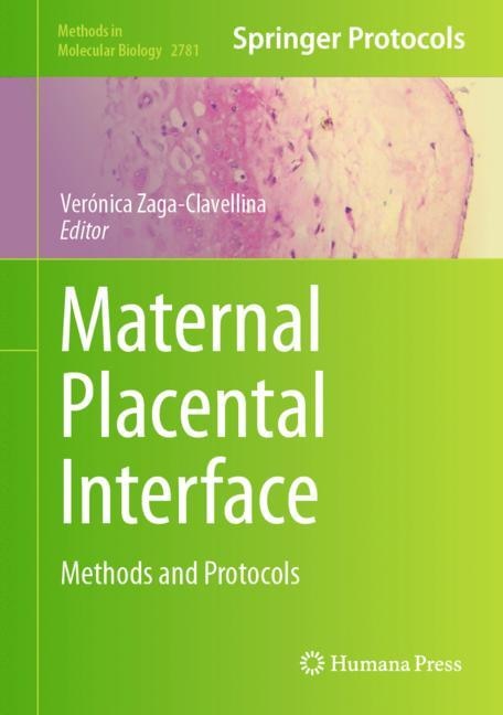 Maternal Placental Interface by Verónica Zaga-Clavellina, Hardcover | Indigo Chapters
